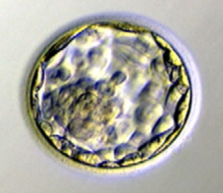 So sánh hiệu quả chuyển phôi tươi và phôi trữ ngày 06 (D6)