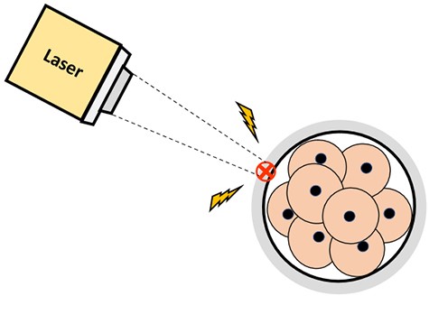 Hiệu quả của hai phương pháp hỗ trợ thoát màng bằng laser trong ART: một tổng quan hệ thống và phân tích tổng hợp