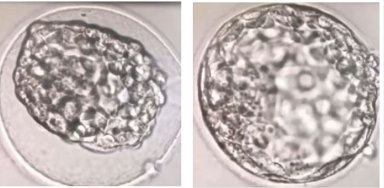 Kết quả mang thai và sơ sinh của phôi nang không tái nở rộng lại khoang phôi ở nhóm bệnh nhân chuyển phôi trữ: có giá trị lâm sàng hay không?