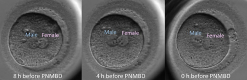 Tiên đoán tiềm năng có trẻ sinh sống bằng kích thước tiền nhân đực và cái  trước khi vỡ màng nhân của hợp tử