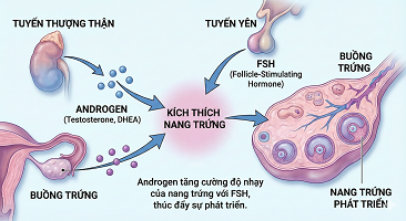 Mối liên quan giữa androgen và đáp ứng buồng trứng trong kích thích buồng trứng