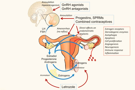Progestin điều trị endometriosis: Cơ chế của thành công và thất bại