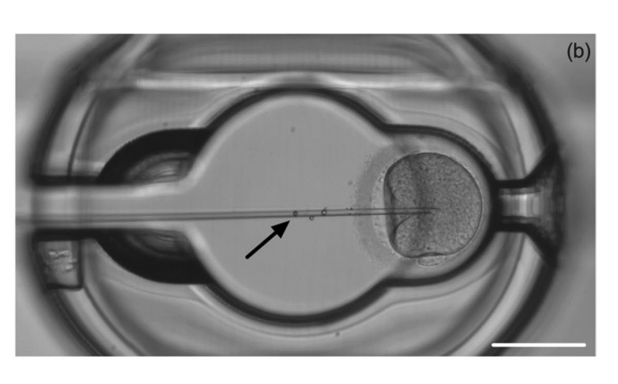 Tổng quan MicroICSI - Một thiết bị tối ưu hóa kỹ thuật tiêm tinh trùng vào bào tương noãn