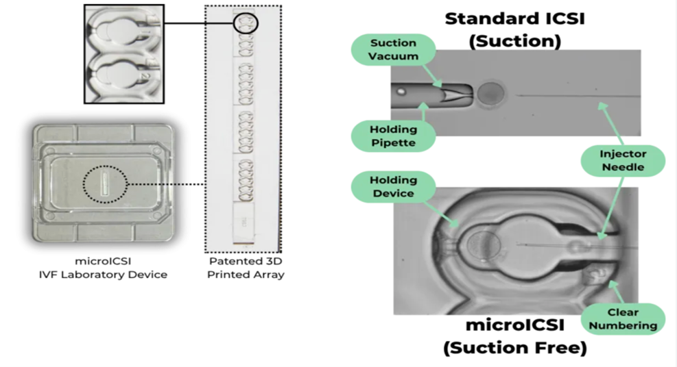 Microicsi và sự phát triển của công nghệ lab-on-a-chip trong hỗ trợ sinh sản